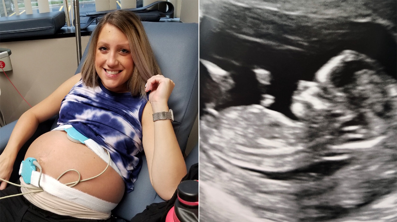 两年后通过注射来保护她的生育,Brittney怀孕了。