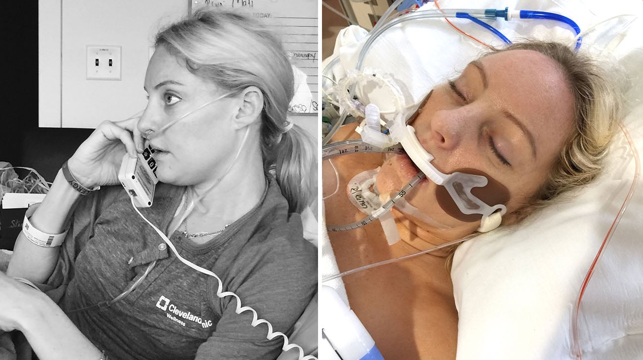 凯蒂·格雷戈里在克利夫兰诊所接受双肺移植手术前后。BOB买球平台
